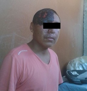 chico piel 1
