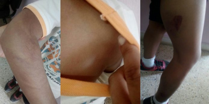 niño-golpeado-piura