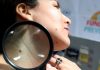 Piura: campaña de detección de cáncer a la piel será hasta el 2 de febrero